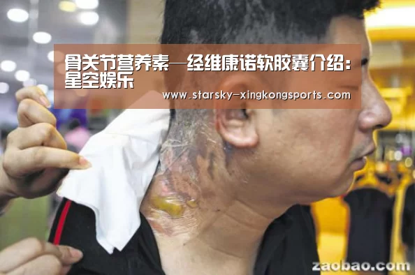 骨关节营养素—经维康诺软胶囊介绍：星空娱乐